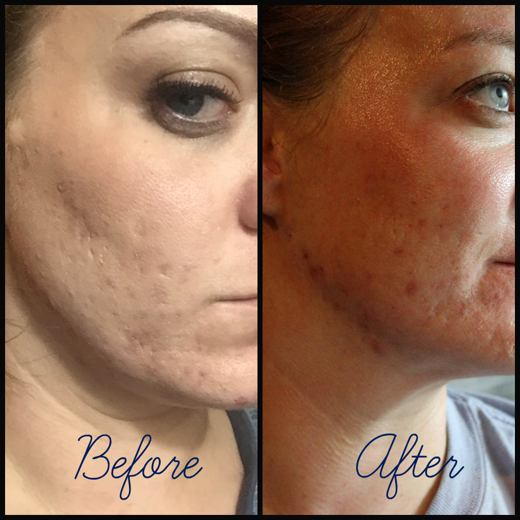 My New Skin With Paula S Choice My New Skin With Paula S Choice