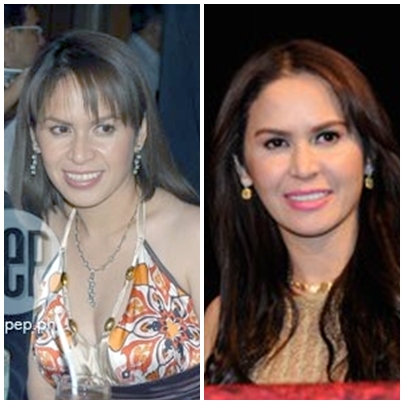 Strictly Pinoy: Jinkee Pacquiao's Enhancements: Before and After