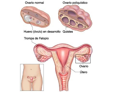 Ovario