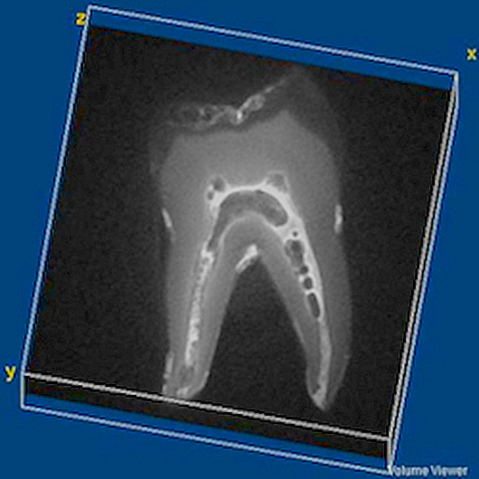 MRI and Medical Imaging New dental MRI study yields best images yet