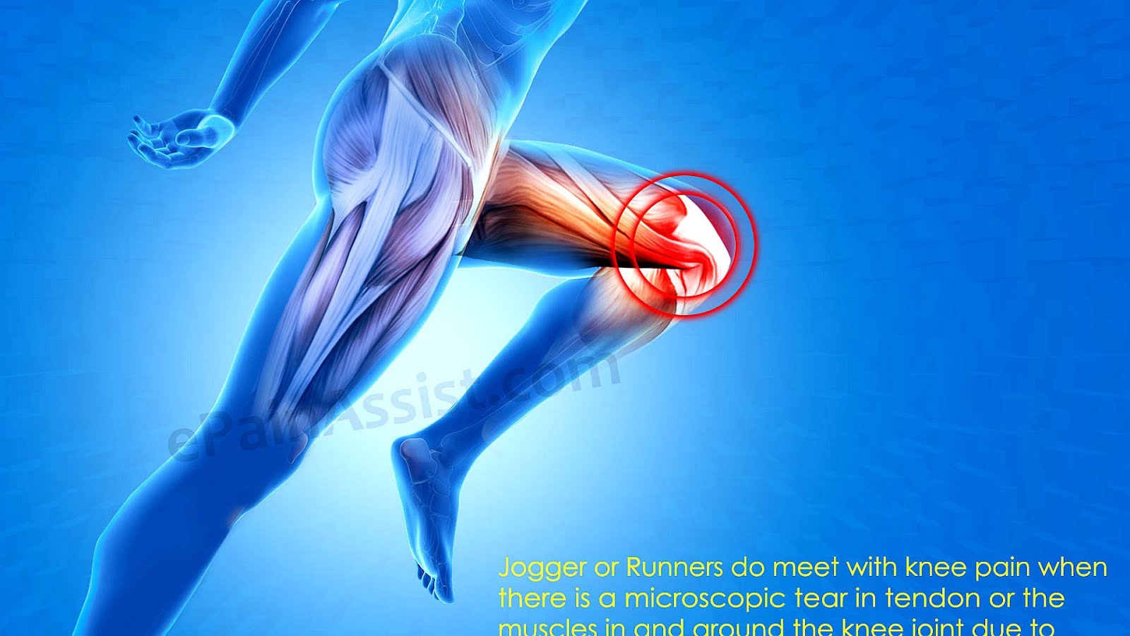 What Causes Knee Pain And Swelling - Knee Choices