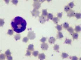 hemoparasitos anaplasma