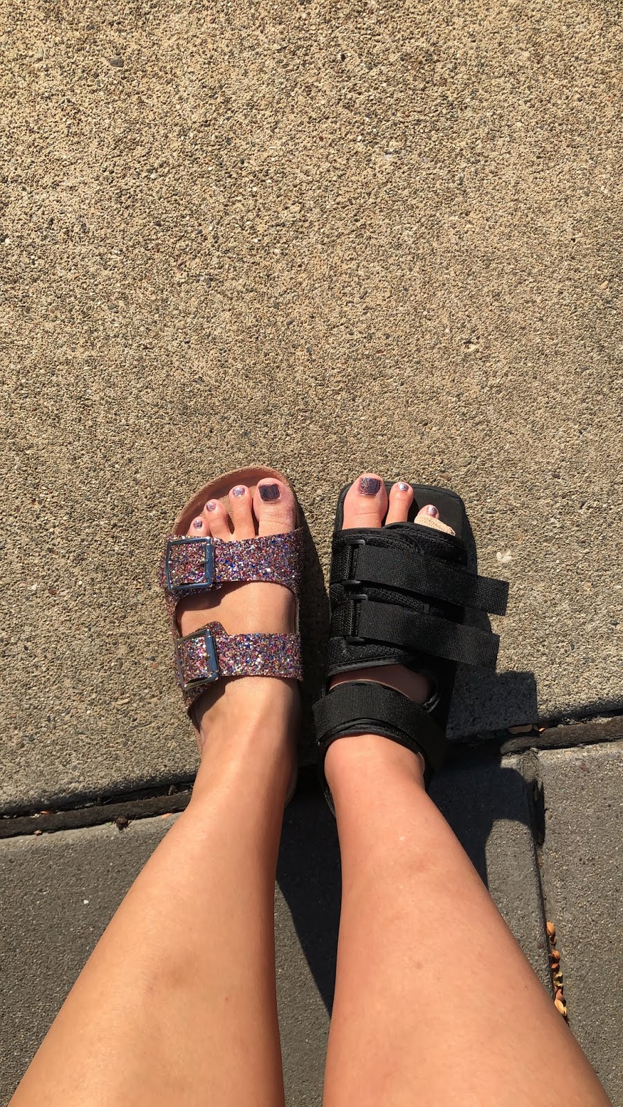 Broken Toe Boot Near Me Woman Says Part Of Leg Amputated After Broken