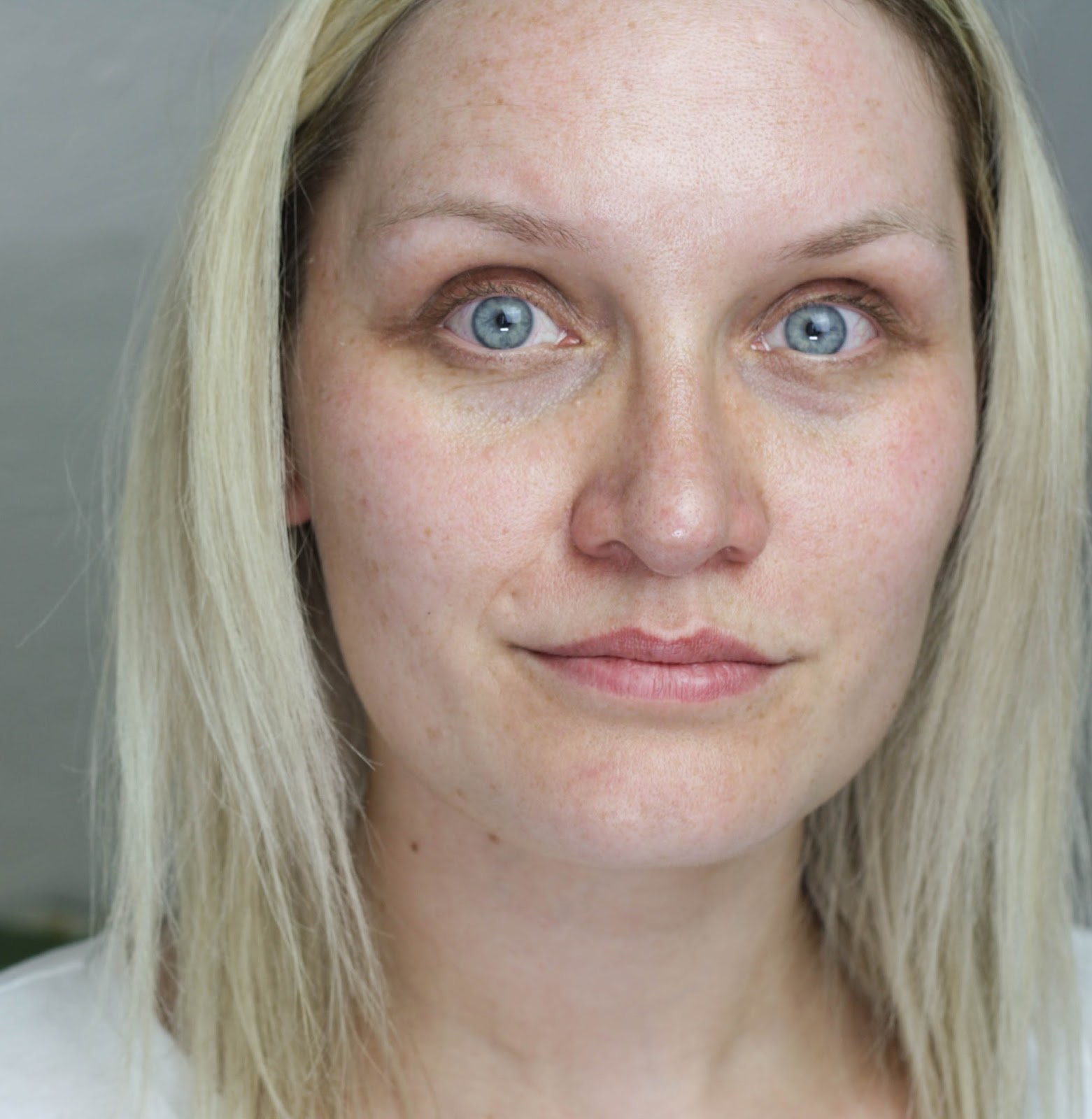 Lumene von den Pigmentflecken