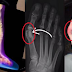 WOMEN'S HEALTH: Wearing High Heels Might Set You In A Lifetime Pain. Read And Watch.