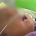 Video: Nace un bebe con 2 narices 