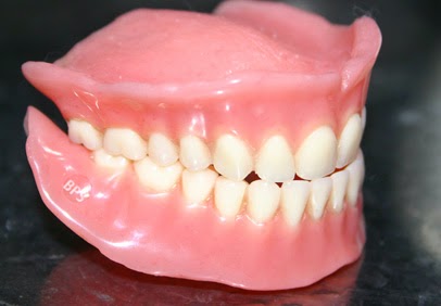 Problèmes de dentier