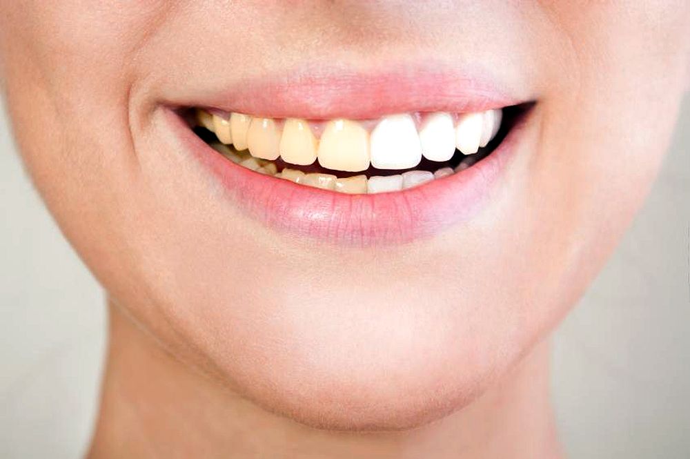 ¿Conoces los alimentos que hacen que