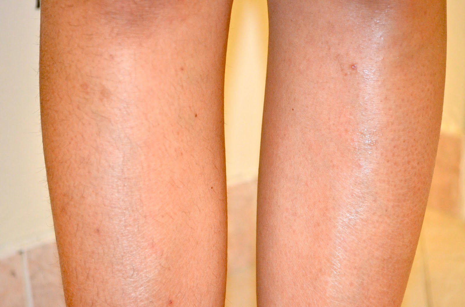 Brazilian Wax Pictures Before And After 9