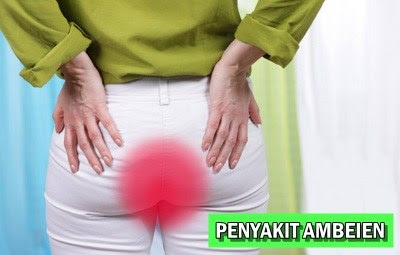 Foto Nama Obat Berak Keluar Darah Menetes Yang Paling Laris