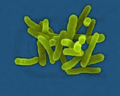 Penyebab Disentri Berasal Dari Pola Hidup Yang Tidak Sehat