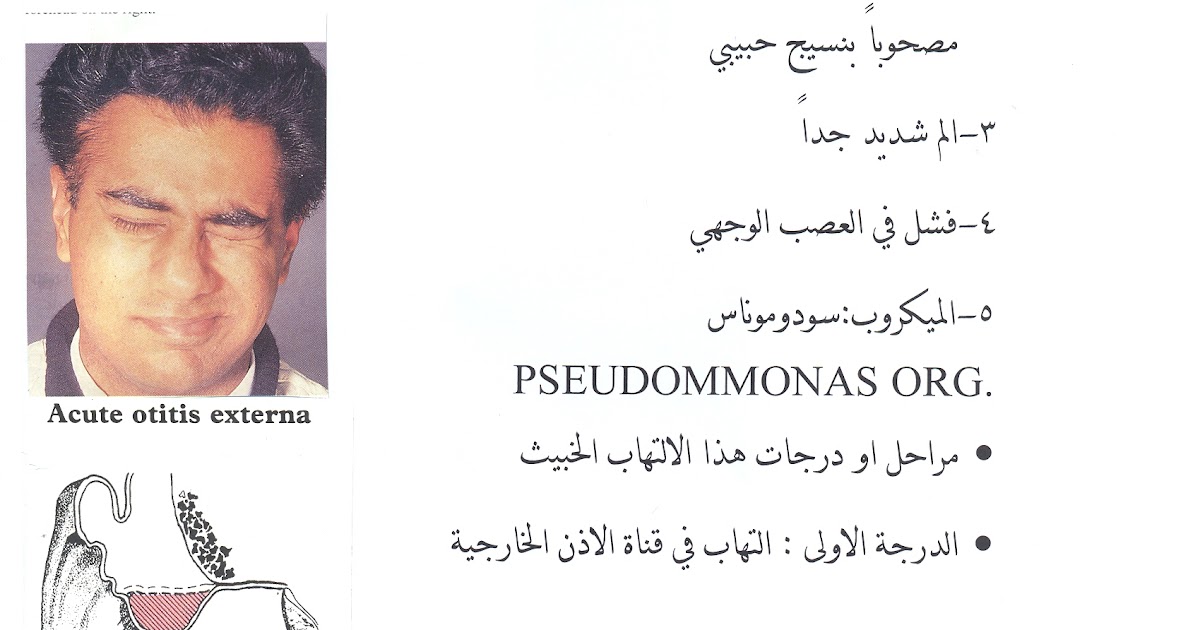 المدونة الطبية د فهيد سالم السبيعي التهاب الاذن الخارجية الخبيث Malignant Otits Externa