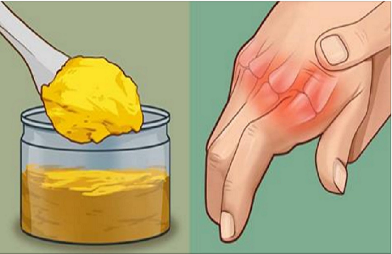 Remove Joint Pain, Cure Arthritis With These Simple Drug