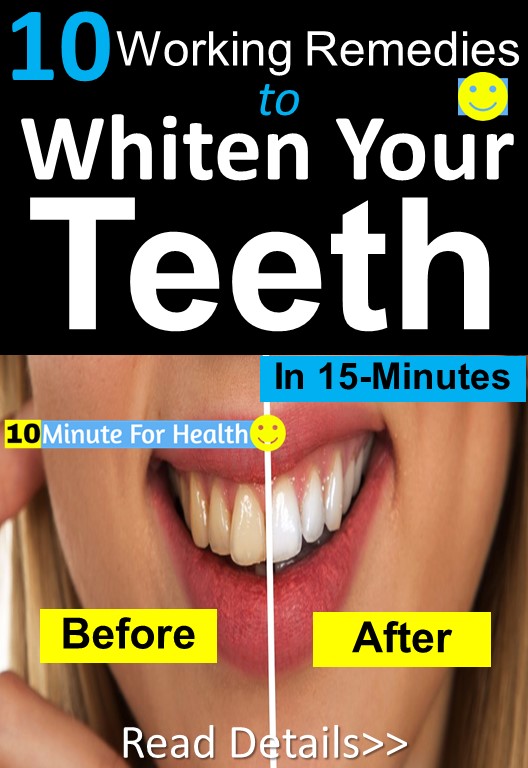 10 Effective Home Remedies to Whiten Teeth 10 Minute For Health