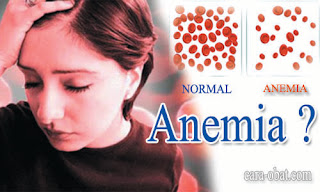 tanda-gejala-anemia