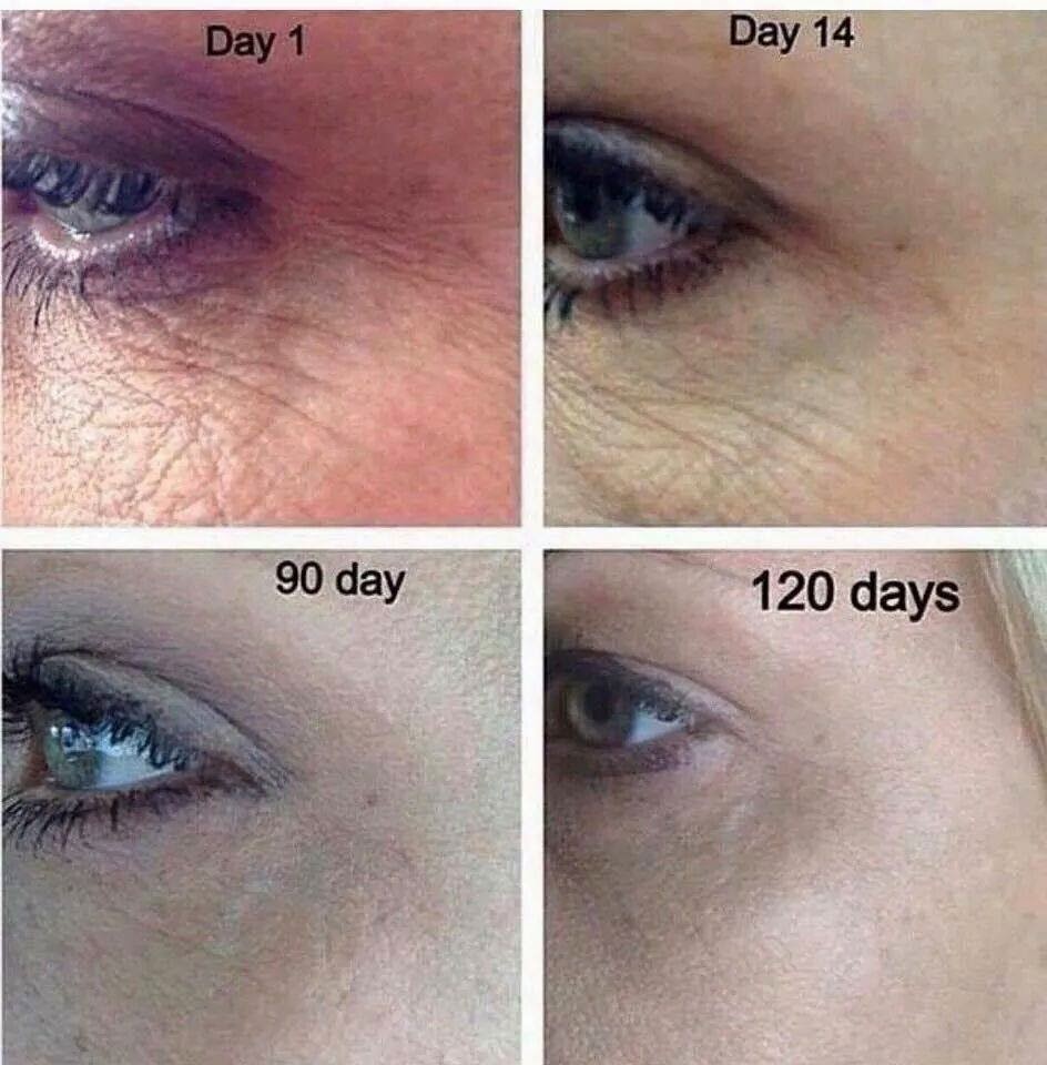 Nerium before and after 1