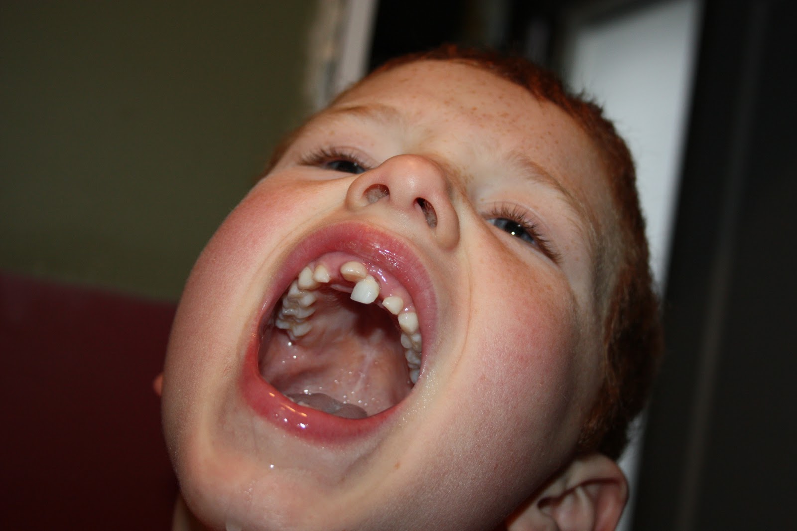 The Hawkins Rerun Tangled teeth