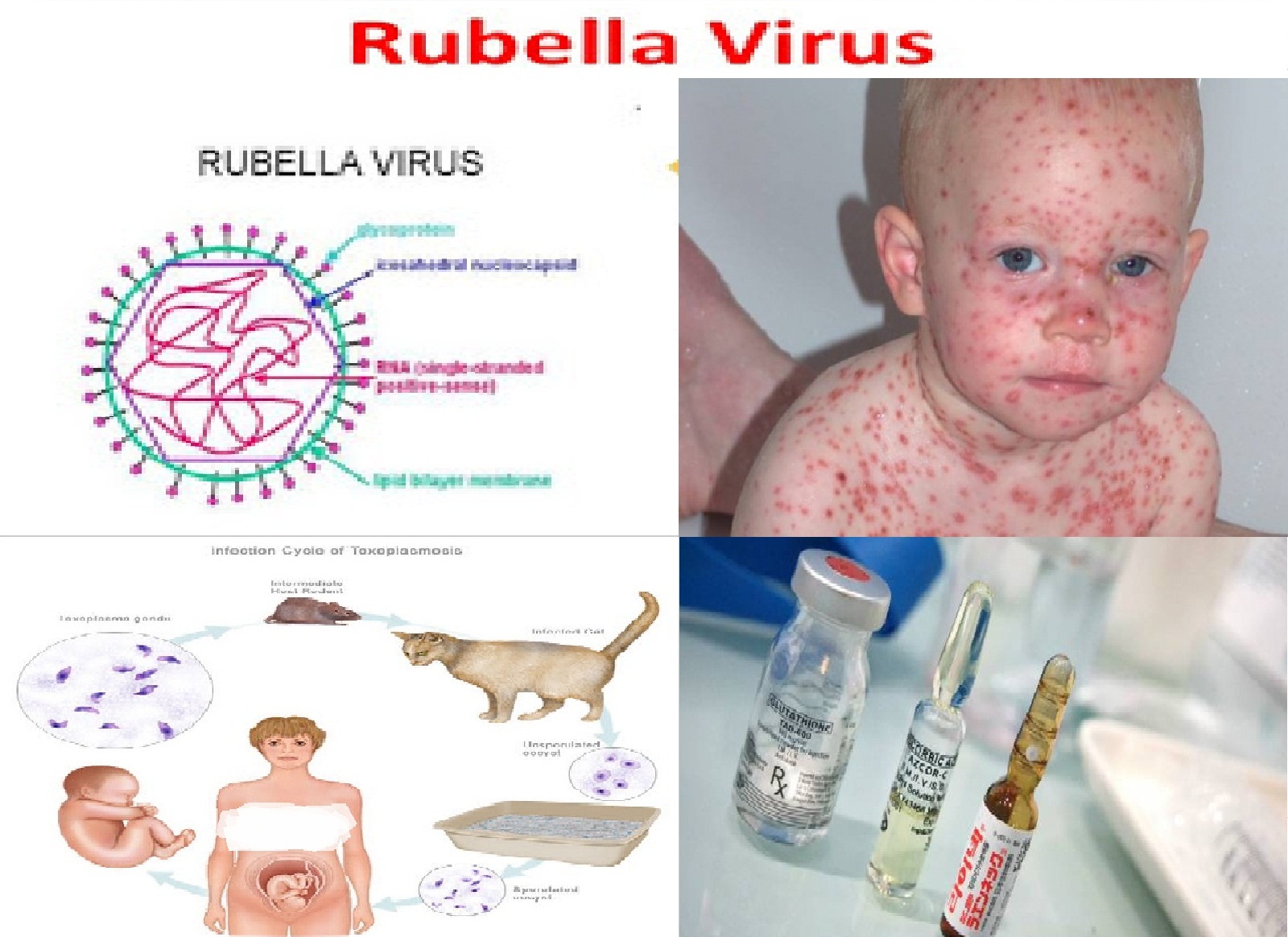 Penyakit Rubella (Campak Jerman) .