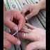 How to easily remove a ring that got stuck in your finger?