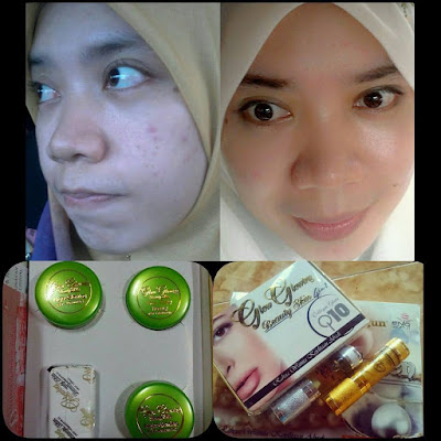 TESTIMONI GLOW GLOWING BEAUTY SKIN
