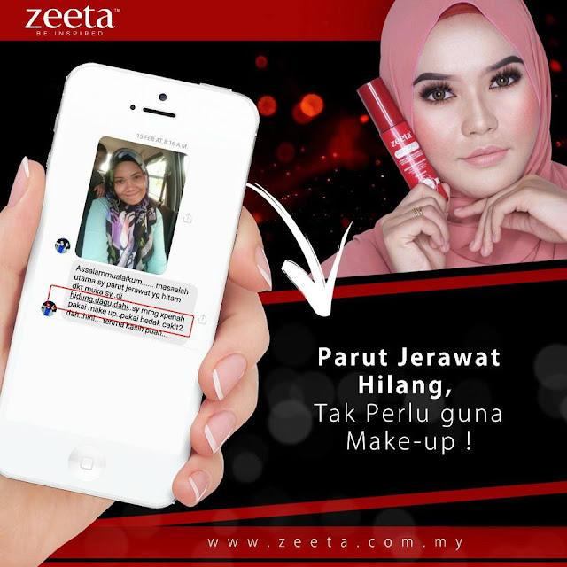 Atasi Masalah Jerawat & Jeragat Dengan Rose Face Serum Zeeta rose face serum, rfs, serum jerawat & jeragat, testimoni rfs