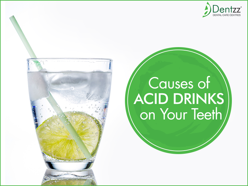 Oral health treatment and consultation by Dentzz Dental Dentzz Acid