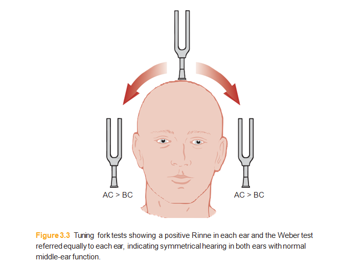 3Testing the hearing مدونة الدكتور حمدى زكريا الطبية