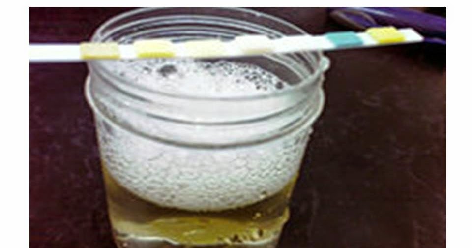 пенится моча у женщин при мочеиспускании причины