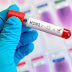 FVS confirma 69 casos de Influenza A H1N1 e 17 mortes