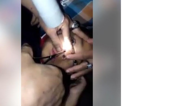 Video: Hati-hati Saat Berlibur Ditempat Berair, Pria Ini Temukan Lintah Didalam Hidung Anaknya Video: Hati-hati Saat Berlibur Ditempat Berair, Pria Ini Temukan Lintah Didalam Hidung Anaknya
