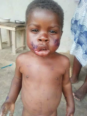 3 Photos: See what a heartless father did to his 3-year-old child for defecating in the bedroom