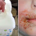 Doctor's Warning: Never Clean Your Child With Baby Wipes No Matter What