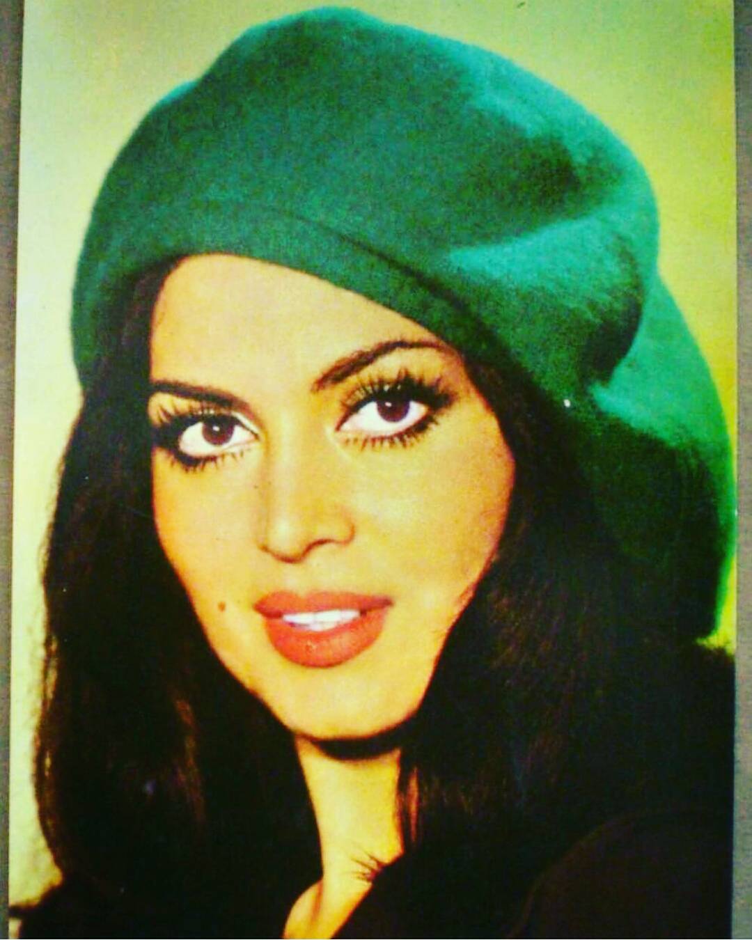 Hülya Koçyiğit Estetiksiz Hali