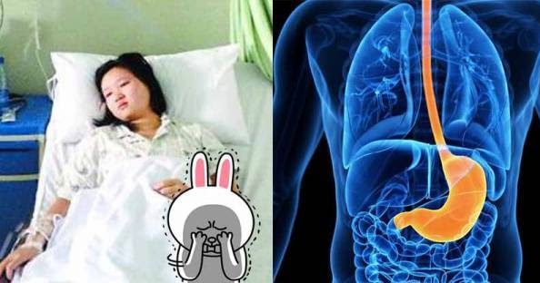 Ngeri! Wanita Usia 30 Tahun ini Nyaris Kena Kanker Kerongkongan Gara