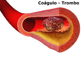 Coágulos tratamento de sanguíneos de para superfície perna
