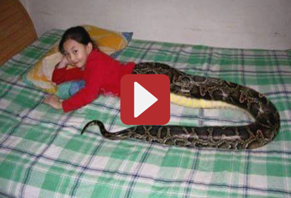 AMAZING KID BORN WITH SNAKE TAIL and STILL ALIVE , WATCH HER V1DEO HER