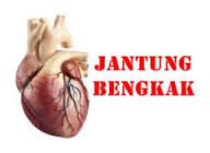 http://greenworldinternasional.com/obat-tradisional-untuk-jantung-bengkak/