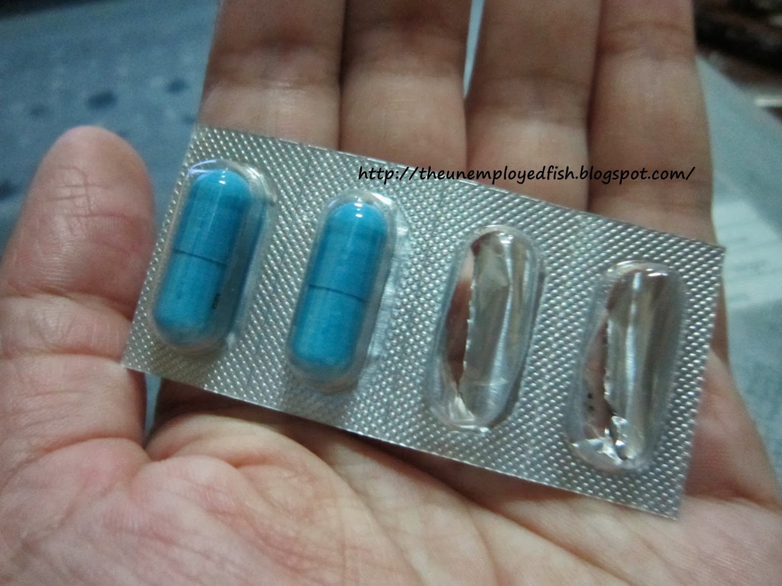 The Unemployed Fish The Xenical Experience My Horror Story