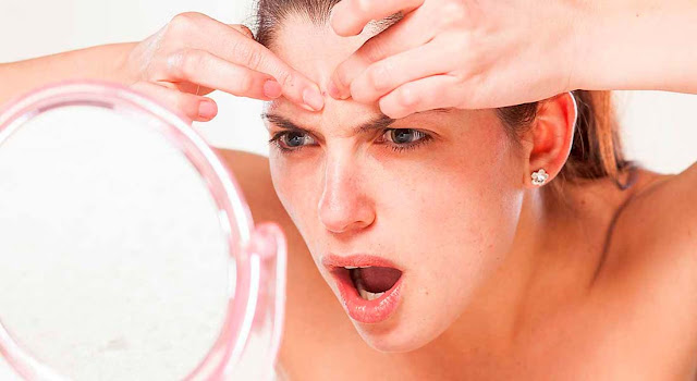 Beauty Tips: How To Conceal Pimples Beauty Tips: How To Conceal Pimples