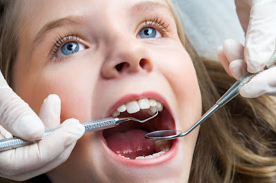 Biện pháp bảo vệ răng sữa cho trẻ em