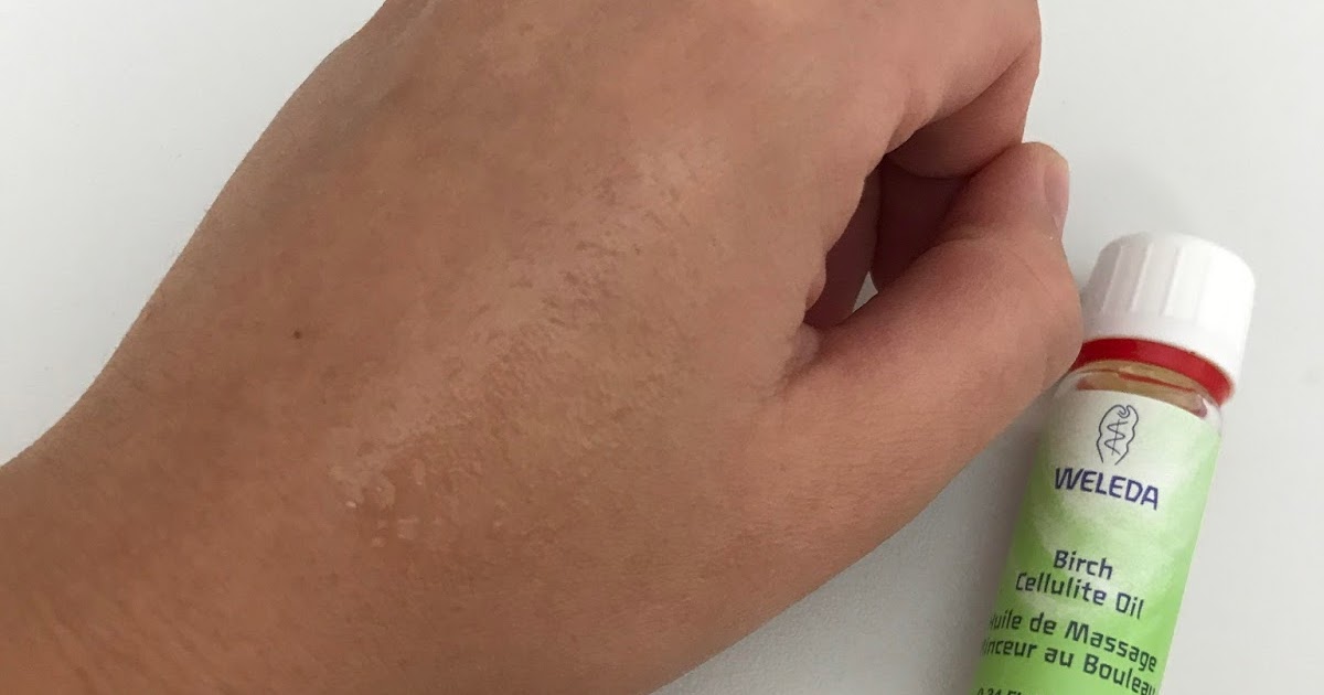 Aceite abedul weleda vs lidl