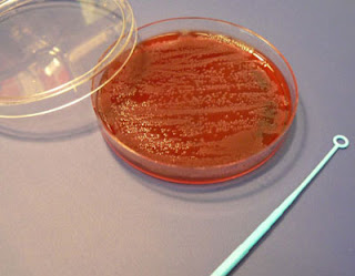 Bacterial culture growing bacteria