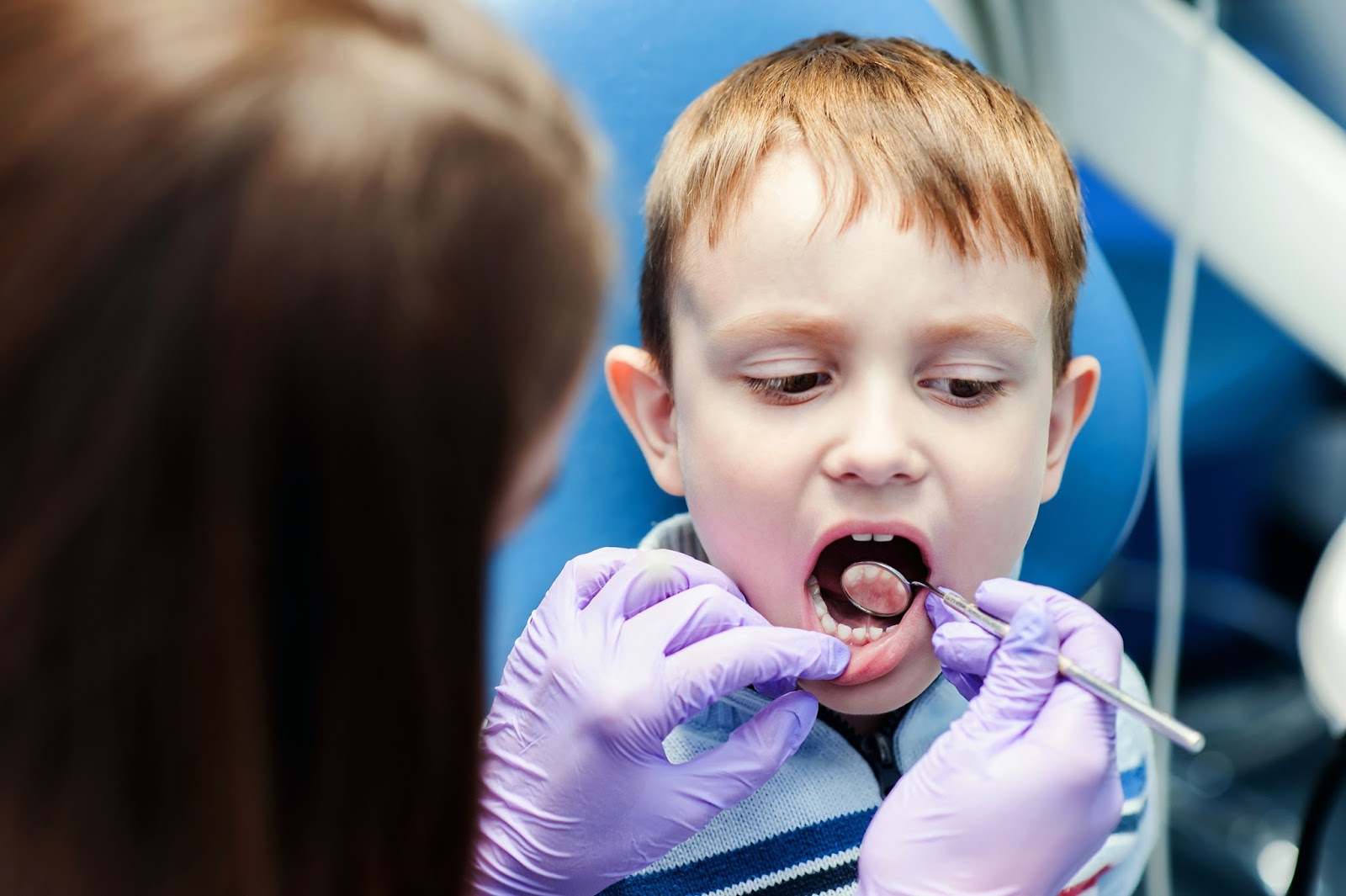 Рот off. Пульпотомия молочных зубов. Детский пульпит молочных зубов. Пульпит молочных зубов детская стоматология. Детские лица кариес.