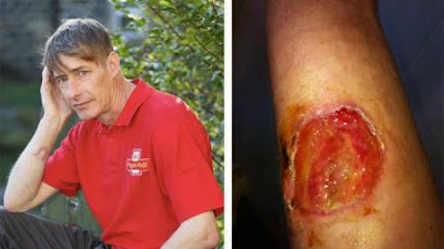 Postman Jason Lee viciously attacked by dog, 