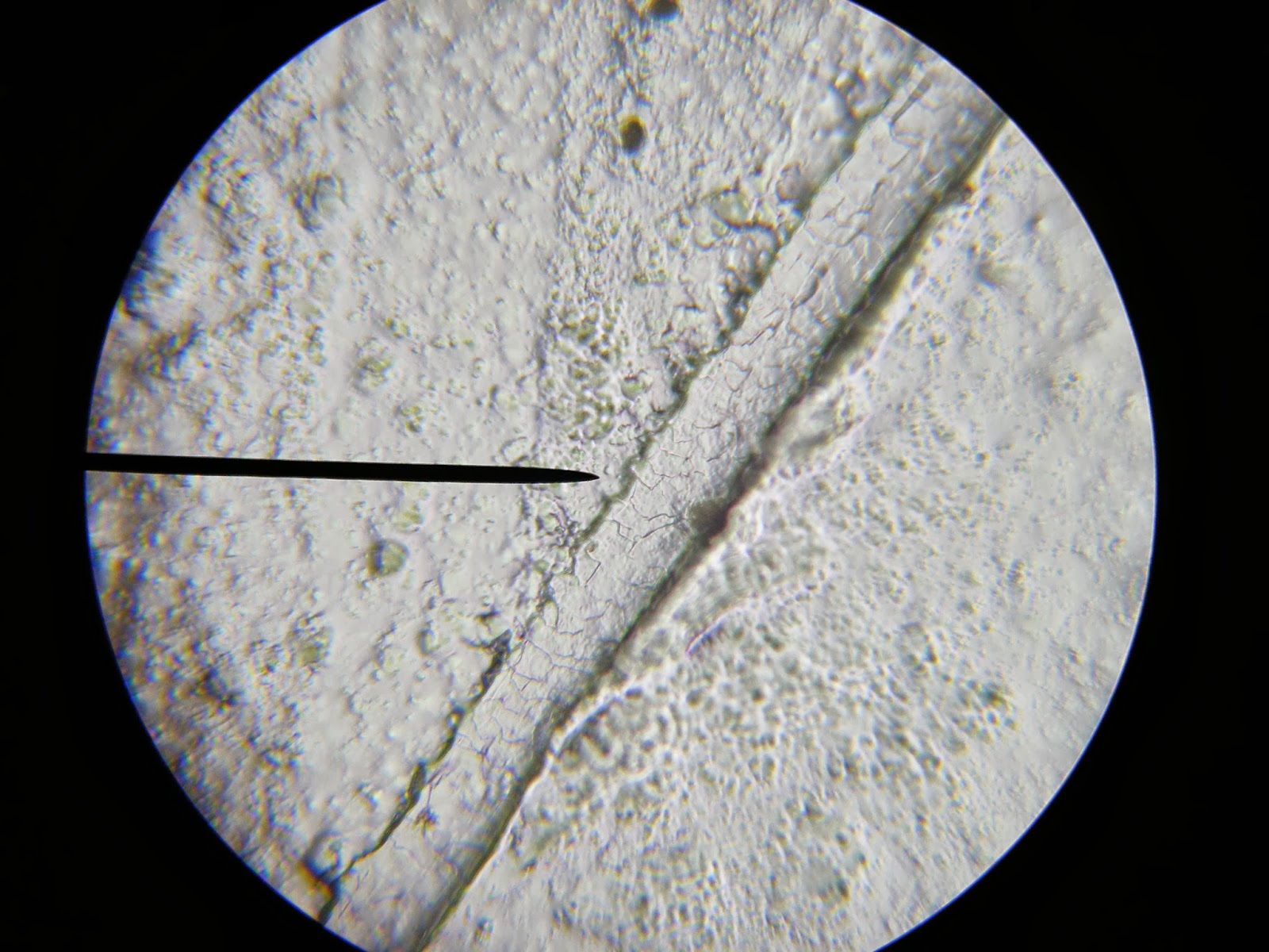 Проект волосы под микроскопом