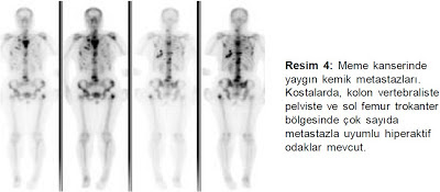 Sintigrafi nedir ? Görüntüleme Yöntemleri Kitapçığı pdf indir - Radyoloji, Nükleer Tıp