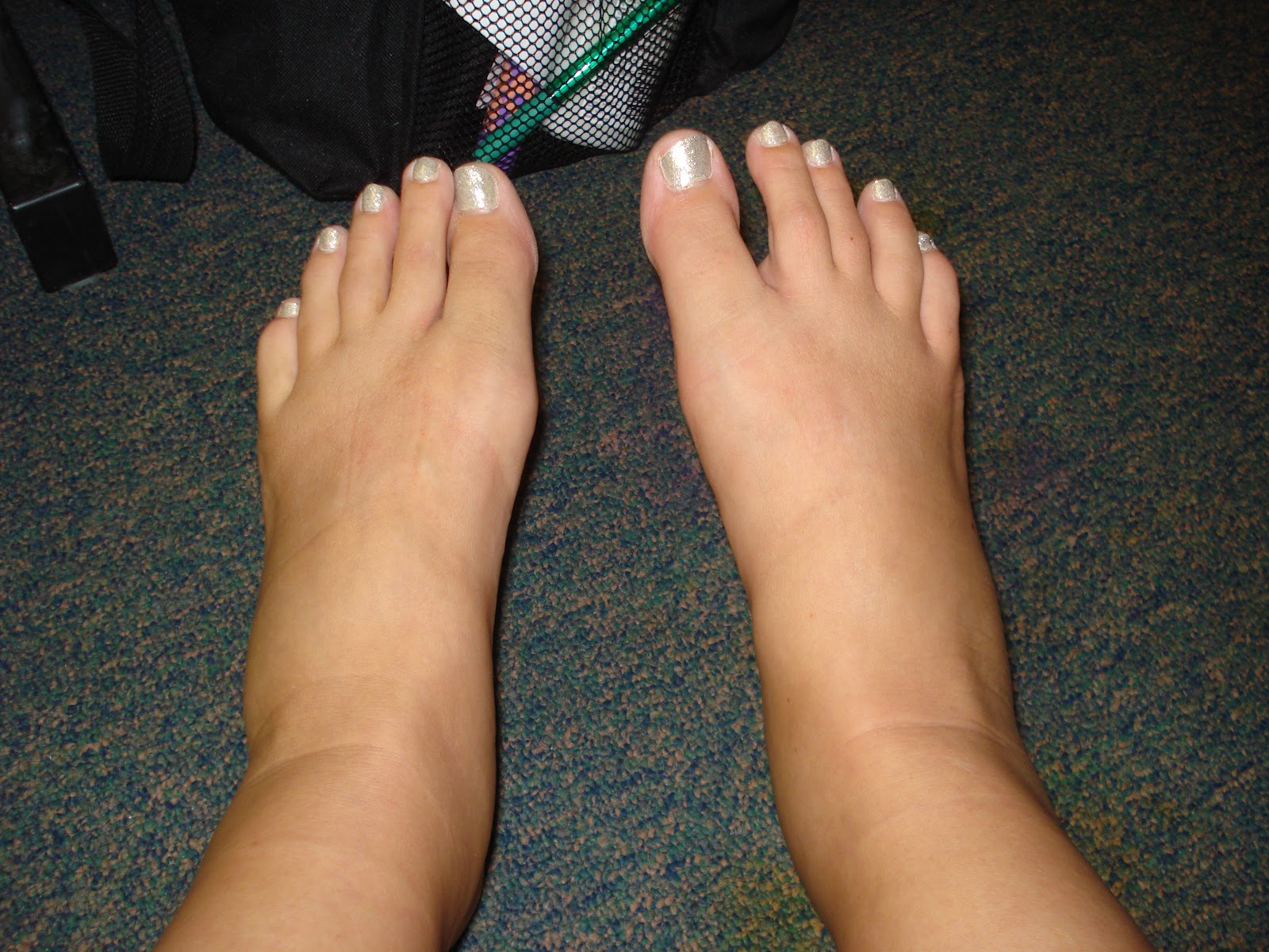 of feet Pictures fat