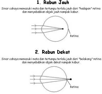 Diari KecikSangat: Atasi Masalah Rabun Tanpa Pemedahan. Jimat Kos.