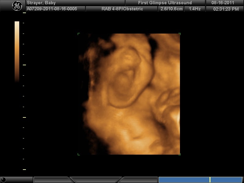 Our Miracle Life: 29 week 4d Ultrasound