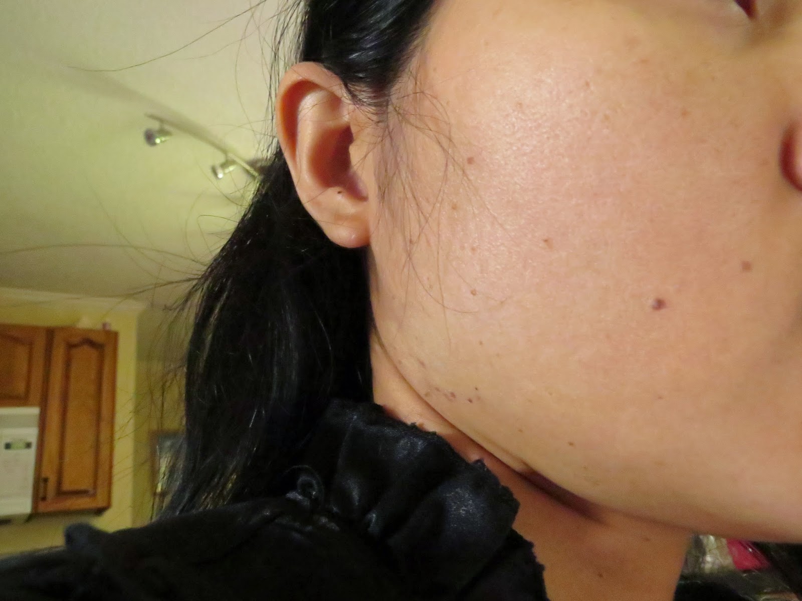 zaks dark spot cream